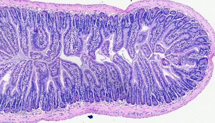 Diagnostic Pathology - 700x400