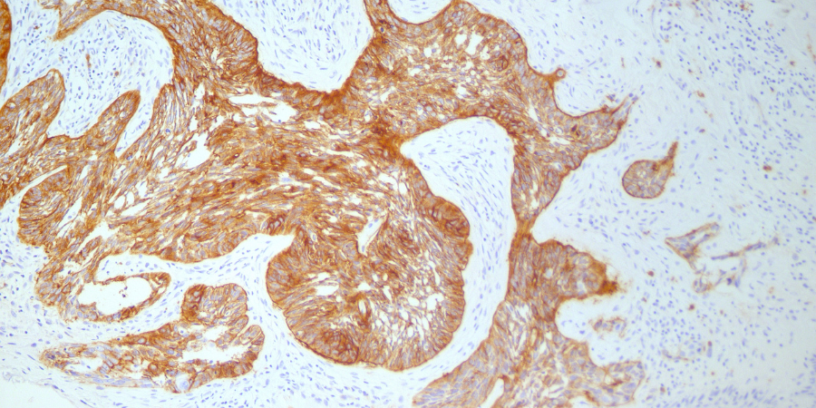 IHC Staining - 900x450