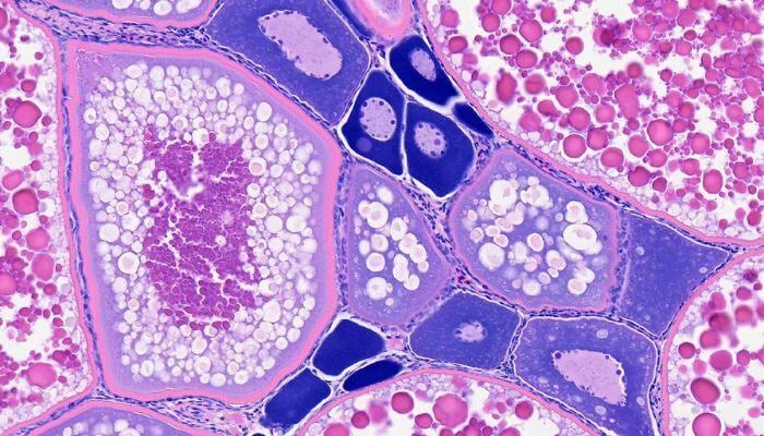 Ovary - 700x400