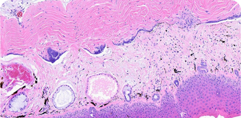 Histology Webinar - 351x173